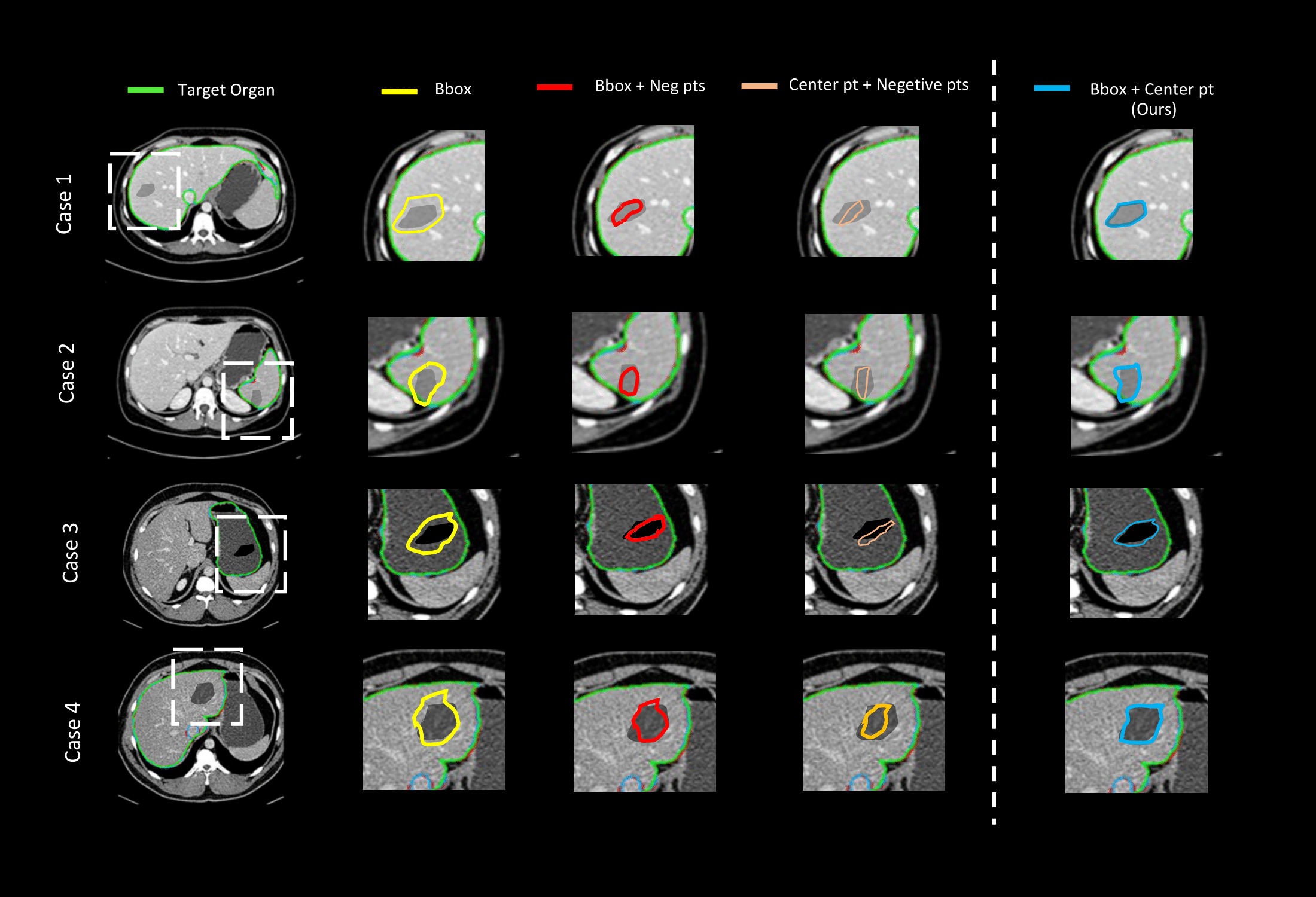 Qualitative Segmentation Results and Prompt Comparison